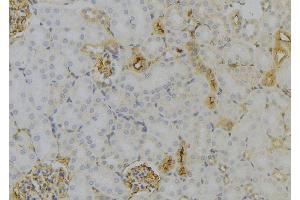 ABIN6279588 at 1/100 staining Mouse kidney tissue by IHC-P. (MT-ND6 antibody)