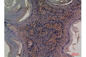 Immunohistochemistry (IHC) image for anti-5'-Nucleotidase, Ecto (CD73) (NT5E) (Internal Region) antibody (ABIN6287281)