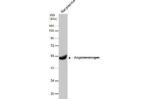 Western Blotting (WB) image for anti-Angiotensinogen (serpin Peptidase Inhibitor, Clade A, Member 8) (AGT) antibody (ABIN2855709)