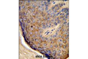 Formalin-fixed and paraffin-embedded human skin tissue reacted with TCHP Antibody , which was peroxidase-conjugated to the secondary antibody, followed by DAB staining. (TCHP antibody  (AA 291-320))