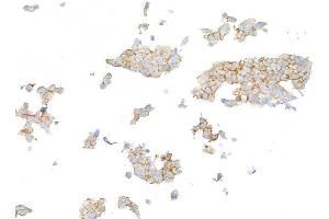 Immunocytochemistry (ICC) image for anti-Receptor tyrosine-protein kinase erbB-2 (ErbB2/Her2) (AA 1205-1255) antibody (ABIN7455181) (Recombinant ErbB2/Her2 antibody  (AA 1205-1255))