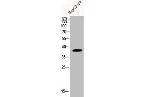 Western Blot analysis of HEPG2-UV cells using Phospho-p38 (Y323) Polyclonal Antibody (MAPK14 antibody  (pTyr323))