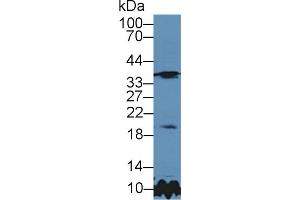 Western Blot; Sample: Rat Cerebrum lysate; Primary Ab: 5µg/ml Rabbit Anti-Rat TIMP3 Antibody Second Ab: 0. (TIMP3 antibody  (AA 27-209))