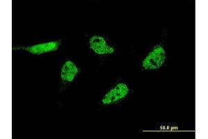 Immunofluorescence of monoclonal antibody to C17orf88 on HeLa cell.