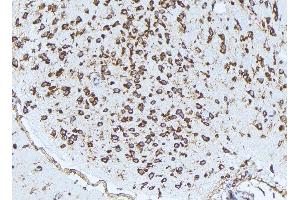 ABIN6272976 at 1/100 staining Rat brain tissue by IHC-P. (PSAT1 antibody  (Internal Region))