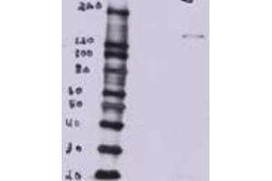 MDCK overexpressing Mouse Btbd7 (third lane) and probed with ABIN768612 (mock transfection in first lane, full construct chemically suppressed in second lane). (BTBD7 antibody  (N-Term))