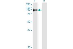 Western Blotting (WB) image for anti-Fibroblast Activation Protein, alpha (FAP) (AA 525-624) antibody (ABIN560844)