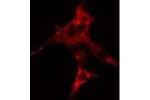 Immunofluorescence (fixed cells) (IF/ICC) image for anti-erythrocyte Membrane Protein Band 4.9 (Dematin) (EPB49) (C-Term) antibody (ABIN6261269)