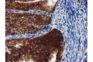 Image no. 9 for anti-Makorin Ring Finger Protein 1 (MKRN1) antibody (ABIN1499486)