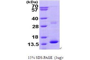 SDS-PAGE (SDS) image for Hemoglobin, zeta (HBZ) (AA 1-142) protein (His tag) (ABIN666976) (HBZ Protein (AA 1-142) (His tag))