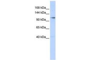 Image no. 1 for anti-Zinc Finger, MIZ-Type Containing 1 (ZMIZ1) (N-Term) antibody (ABIN6740601) (ZMIZ1 antibody  (N-Term))