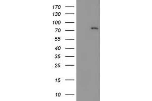 LIM Domain Kinase 1 antibody