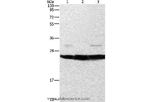 Western blot analysis of Mouse liver and brain tissue, A549 cell, using SIGMAR1 Polyclonal Antibody at dilution of 1:310 (SIGMAR1 antibody)