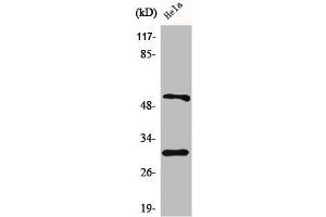 Western Blot analysis of HeLa cells using Caspase-10 B/C Polyclonal Antibody (Caspase 1 antibody  (C-Term))