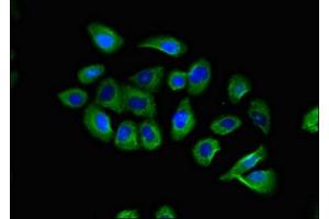 Immunofluorescent analysis of A549 cells using ABIN7145918 at dilution of 1:100 and Alexa Fluor 488-congugated AffiniPure Goat Anti-Rabbit IgG(H+L) (CCR1 antibody  (AA 314-362))