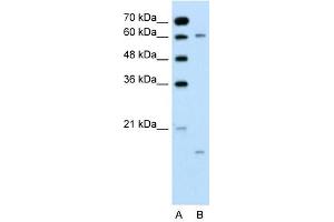CYP4A22 antibody  (N-Term)