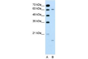 CYP4A22 antibody used at 0. (CYP4A22 antibody  (N-Term))