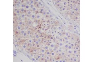 Immunohistochemical analysis of paraffin-embedded human testis, using MAP1LC3A Antibody. (Recombinant MAP1LC3A antibody)