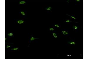 Immunofluorescence of monoclonal antibody to LHX4 on HeLa cell. (LHX4 antibody  (AA 291-390))