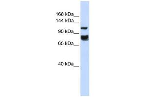 WB Suggested Anti-HDAC4 Antibody Titration:  0. (HDAC4 antibody  (Middle Region))