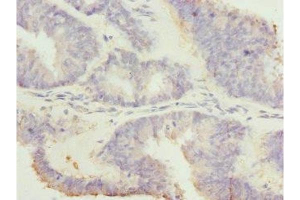 RGS7 antibody  (AA 1-300)