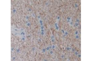 Used in DAB staining on fromalin fixed paraffin- embedded Kidney tissue (NOV antibody  (AA 139-357))
