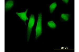Immunofluorescence of monoclonal antibody to PTPN12 on HeLa cell. (PTPN12 antibody  (AA 682-779))