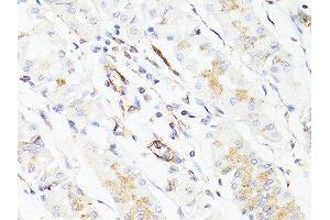 Immunohistochemistry of paraffin-embedded human stomach using VIM antibody. (Vimentin antibody  (AA 1-101))