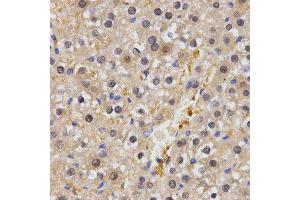 Immunohistochemistry (IHC) image for anti-Heat shock factor protein 2 (HSF2) antibody (ABIN6219790) (HSF2 antibody)