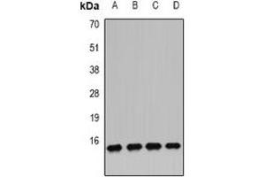 Western blot analysis of IFI6 expression in MCF7 (A), U251 (B), U937 (C), mouse pancreas (D) whole cell lysates. (IFI6 antibody)