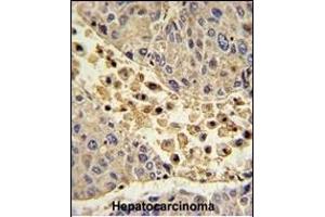 Immunohistochemistry (Paraffin-embedded Sections) (IHC (p)) image for anti-Collectin Sub-Family Member 11 (COLEC11) (AA 50-78), (N-Term) antibody (ABIN390822)