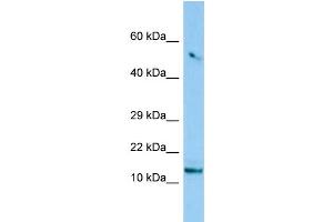 WB Suggested Anti-C8orf4 Antibody Titration: 1. (C8orf4 antibody  (N-Term))