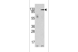 Western blot analysis of TAOK3 using rabbit polyclonal TAOK3 Antibody using 293 cell lysates (2 ug/lane) either nontransfected (Lane 1) or transiently transfected with the TAOK3 gene (Lane 2). (TAO Kinase 3 antibody  (C-Term))