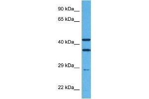Host:  Rabbit  Target Name:  TREM2  Sample Tissue:  Human Jurkat Whole Cell  Antibody Dilution:  1ug/ml (TREM2 antibody  (Middle Region))