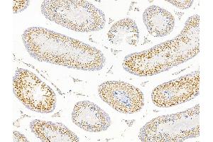 ABIN7094799 and ABIN7098850 at 1/100 staining Mouse testis tissue by IHC-P. (Forkhead Box K2 antibody  (C-Term))