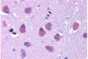 Human Brain (formalin-fixed, paraffin-embedded) stained with BRS3 antibody ABIN213383 at 10 ug/ml followed by biotinylated goat anti-rabbit IgG secondary antibody ABIN481713, alkaline phosphatase-streptavidin and chromogen. (BRS3 antibody  (Cytoplasmic Domain))