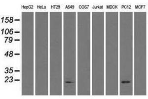 Image no. 2 for anti-Crystallin, alpha B (CRYAB) antibody (ABIN1497644) (CRYAB antibody)