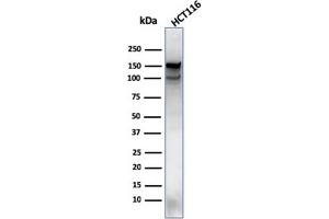 Western Blot Analysis of HCT116 cell lysate using MSH6 Mouse Monoclonal Antibody (MSH6/3089). (MSH6 antibody  (AA 374-540))