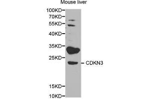 Western blot analysis of extracts of mouse liver, using CDKN3 antibody.