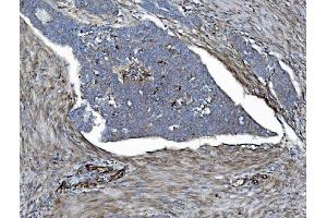 IHC analysis of EHD3 using anti-EHD3 antibody (ABIN7602777). (EHD3 antibody  (C-Term))