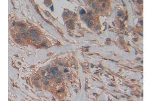 Used in DAB staining on fromalin fixed paraffin- embedded kidney tissue (PKM2 antibody  (AA 141-248))