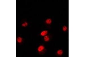 Immunofluorescent analysis of POLR3E staining in Hela cells.