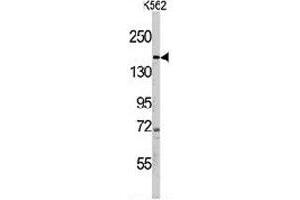 Western blot analysis of PHLPP1 polyclonal antibody  in K-562 cell line lysates (35 ug/lane). (PHLPP1 antibody  (N-Term))