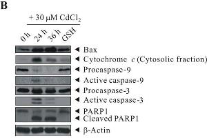 Western Blotting (WB) image for anti-Poly (ADP-Ribose) Polymerase 1 (PARP1) antibody (ABIN2854798)