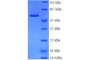 SDS-PAGE (SDS) image for Annexin A9 (ANXA9) (AA 8-345), (partial) protein (His-SUMO Tag) (ABIN5709047)