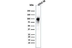 Western Blot Analysis of COLO-38 cell lysate using gp100 Mouse Monoclonal Antibody (PMEL/2039).