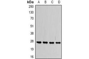 Western blot analysis of VAP-B/C expression in SW480 (A), HepG2 (B), Raji (C), mouse brain (D) whole cell lysates. (VAPB antibody)