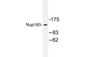Image no. 1 for anti-Nucleoporin 160kDa (NUP160) antibody (ABIN317926) (NUP160 antibody)