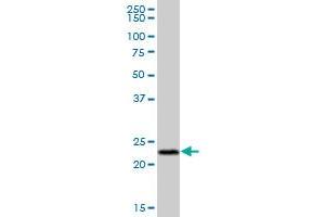 PYCARD MaxPab polyclonal antibody. (PYCARD antibody  (AA 1-195))