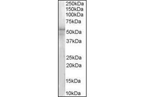 (1µg/ml) Staining of Hela lysate (35µg protein in RIPA buffer). (IRAK4 antibody  (N-Term))